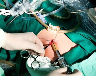 Laparoscopic Protective Cover