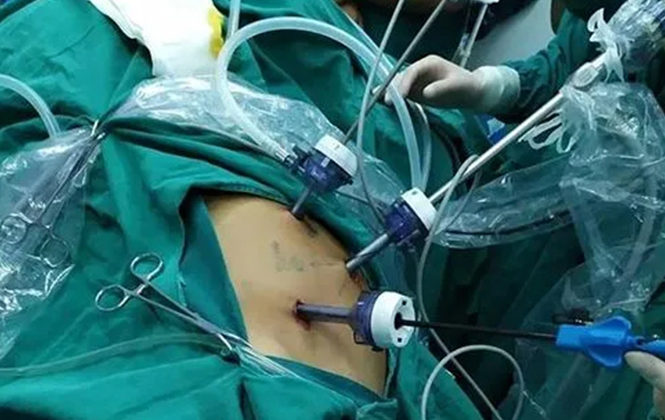 Specialized for laparoscopic instrument cables